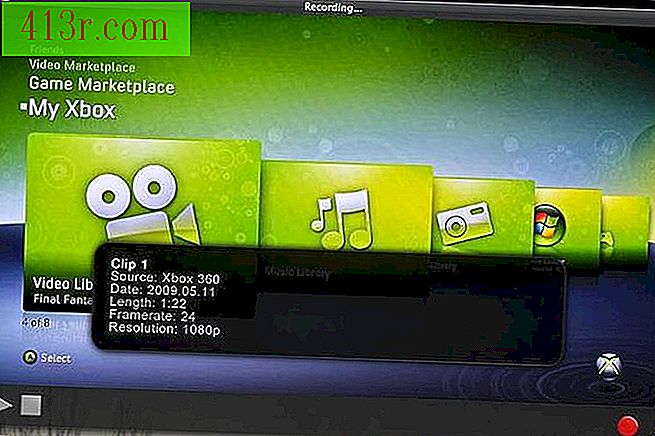 Xbox 360 דרך מחשב נייד.